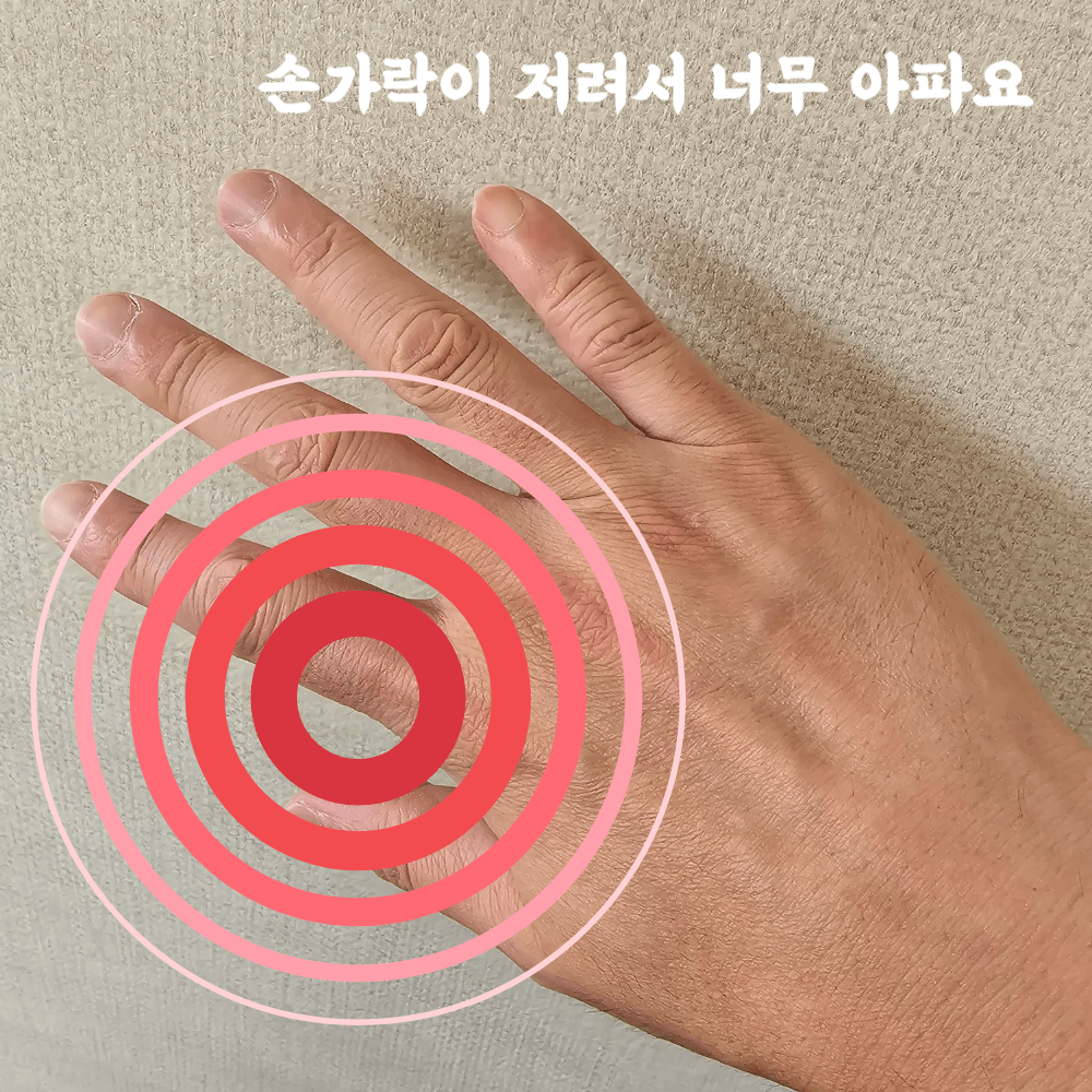저린 손가락을 촬영한 이미지